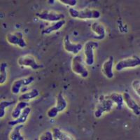 ameba-naegleria-fowleri-conhecida-como-ameba-comedora-de-cerebros-1690901559352_v2_900x506