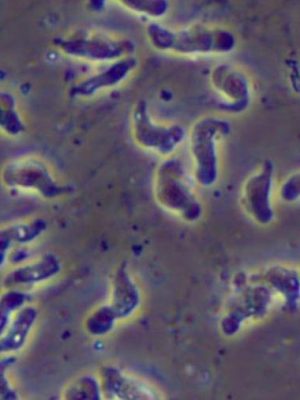 ameba-naegleria-fowleri-conhecida-como-ameba-comedora-de-cerebros-1690901559352_v2_900x506