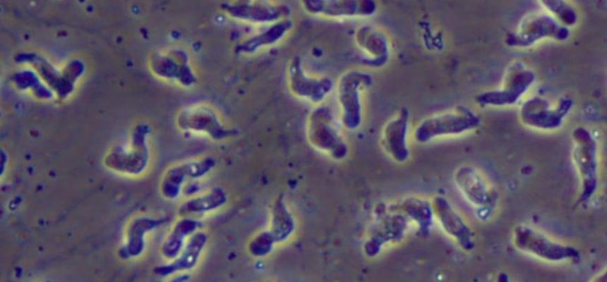 ameba-naegleria-fowleri-conhecida-como-ameba-comedora-de-cerebros-1690901559352_v2_900x506